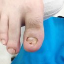 푸스케어 남포점 글림네일 이미지