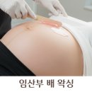 진해구 ⓒ-28 | 임산부 배 왁싱 시기 모낭염 괜찮을까