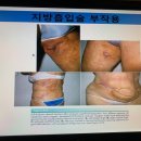 뉴클럽33 이미지