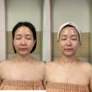 포이에마 | 수원 영통 윤곽관리 포이에마피부샵 리프팅 후기