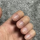 바이탈케어 주식회사 | 손톱영양제 마이크로셀 바이탈 맥스 손톱영양제 추천 후기