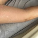 [노원 다이어트] 누워서 편하게 살 빼자! 에소코핏 EMS &amp; 체온테라피 솔직 후기 (예비신부 다이어트)