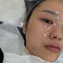 남위례 피부관리 새결뷰티 : 엑소좀 물방울 리프팅 재생관리 후기