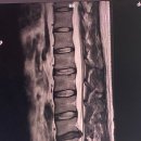 버썸버디짐 | 동탄 반송동 PT 버썸버디짐 1년 후기!