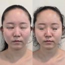 영등천 | [천안 쌍용동 윤곽관리] 비칠영에스테틱 후기 : 얼굴 비대칭부터 목·두피·데콜테까지 제대로 힐링
