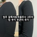 양이멍이 | 청주 팔뚝지방추출주사 2주차 멍 붓기 후관리 후기