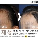 모재성성형외과의원 이미지