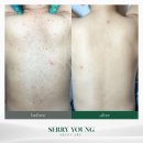 세리영 스킨케어 이미지