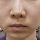 올림피움채움올피채의원 이미지