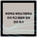 아나덴 슈가링왁싱 부천옥길점 | 부천왁싱 부천슈가링왁싱 자극 적고 매끔한 피부 관리 후기