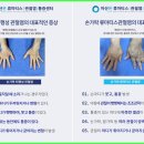 마디케어 이미지