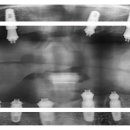 해인치과기공소 이미지