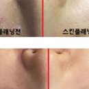 담플레닝 네이버블로그