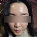 숨 피부관리 | [피부] :: 제천 피부관리샵 숨 솔직후기