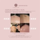 올뷰티의원대전유성 이미지