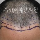 뉴헤어라인 - 순천시 | 뉴헤어라인