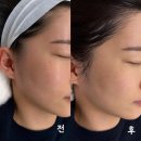 월곡 | 월곡 피부관리 도도미 왁싱 에스테틱 월곡본점 라라필 후기