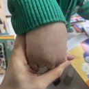 민감성 피부에 적합한 유아크림 아토바이옴