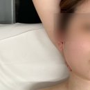아름다움플러스 | 대구 피부관리 [라플러스 에스떼] 방문 후기