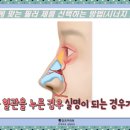 코미인의원 | 천안코필러 나에게 맞는 필러 제품 선택하는 방법(시너지 높이는 방법)