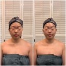 서면윤곽관리추천 카리언뷰티클리닉 본점 씨엘근막관리 후기