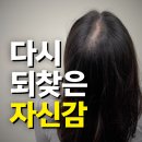 부평삼산 | 부평삼산두피문신 후기, 잃어버린 자신감 찾은 '내돈내산' 리얼 리뷰