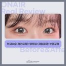 온에어성형외과의원