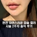 너무 자연스러운 입술 컬러 시술 아름나움 솔직후기 / 유지 수포 강남 통증 색깔