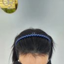 촘촘스칼프