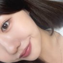 (주)디자인본인테리어 | 애교살필러 처음 맞아본 사람의 만족후기, 국산필러 일주일차 변화