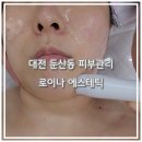 둔산동피부샾 "로이나에스테틱" 물방울 리프팅 후기