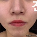 끌리네피부관리아중인후점 네이버블로그