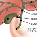 올리브유 간청소 인디언 요법 이미지