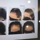 미가톡톡미용실 - 창원시 마산회원구 합성남3길 72 | ​[대구두피] 온미SMP대구, 세심하고 꼼꼼한 원장님의 1:1 퍼스널 스타일 관리 솔직 후기! (지인 추천 100%)