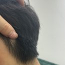 모바이오두피크리닉 이미지
