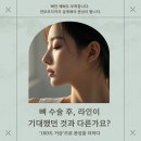 다움성형외과의원 | 다움성형외과 김대현 원장 180도 거상 후기와 비밀 솔루션