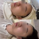 유약국 | 서면피부관리, 데자뷰메디스킨 부산점 솔직 후기! 9천원에 피부관리 받는 꿀팁까지