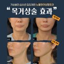 노블와이성형외과의원 이미지