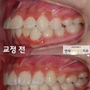연세미소담은치과 이미지