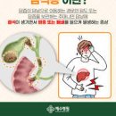 위경련 증상 통증 및 급성 위경련 대처법 알아봐요 이미지