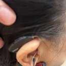 청명보청기센터 | 타센터 한 달 착용 실패 후, 필립스보청기 춘천센터에서 '포낙 오데오 I50'으로 광명 찾으신 70...