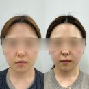 태화중앙로(태화동) | 💆🏻‍♀️ 안동 윤곽관리 <손수에스테틱> 베이직 윤곽관리 대만족 솔직후기