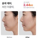 메디큐브 울트라튠 사용법부터 효과까지! 피부 얇은 나의 리얼 사용후기 내돈내산