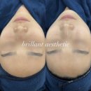 브리앙뜨 이미지