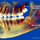 문정치과의원 이미지