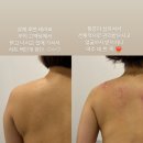 오른에스테틱 네이버블로그