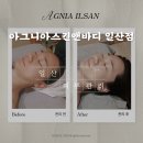 지소아스킨앤바디 | [일산피부관리 추천] 장항동 윤곽관리 리뷰 – 아그니아스킨앤바디 일산점 후기