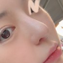 유노성형외과의원 네이버블로그