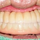 아치치과기공소 이미지