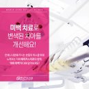 건대치과에서 받은 치아미백 후기, 하루 만에 환해진 미소 | 매직키스치과